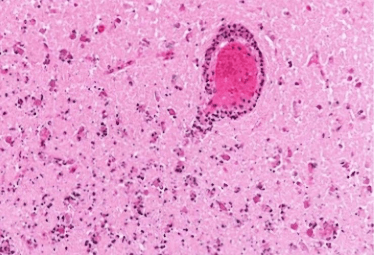 Neuroimagem do acervo BMF4
