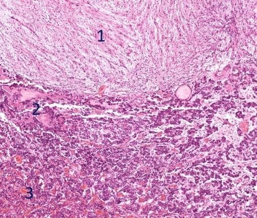 Histologia da hipófise