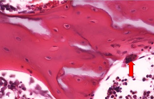 Micrografia do material original com marcador em estrutura a identificar.