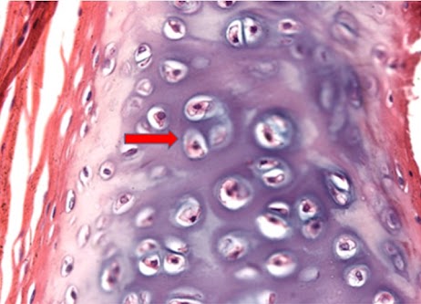 Micrografia de tecido cartilaginoso com matriz rosada e células em lacunas; seta em uma célula.