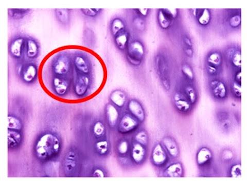 Micrografia de cartilagem com círculo vermelho envolvendo vários condrócitos próximos em lacunas.
