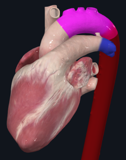 Modelo cardíaco, com porção curva da aorta destacada em magenta.