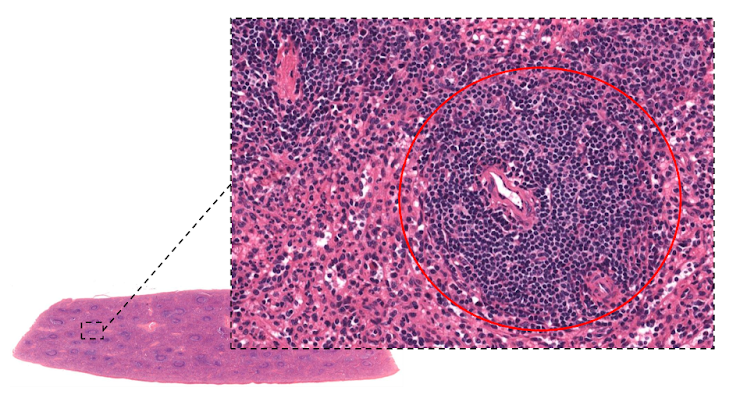 Micrografia do baço, com área circular da polpa branca delimitada.