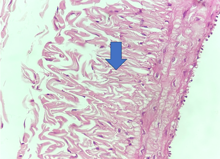 Recorte histológico de parede vascular com seta na camada conjuntiva externa; o lúmen está fora do campo.