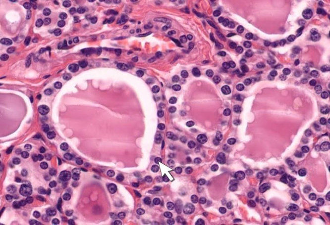 Histologia de folículos tireoidianos e células foliculares