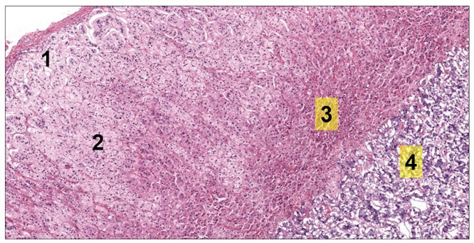 Histologia do córtex e medula suprarrenal com zonas numeradas